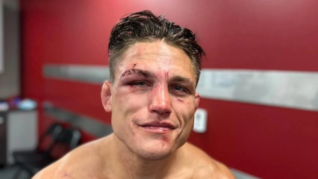 UFC Star Drew Dober Comforts Fans After Bloody Fight