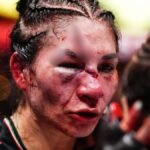 UFC Fans Shocked by Fighter’s Horrific Facial Injury in Las Vegas Fight